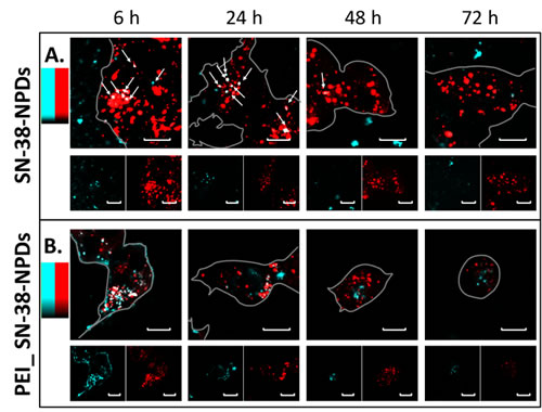 Fluorescence images of NPDs (in blue) co-localizing and degrading inside lysosomes (in red) over time. ⒸTohoku University
